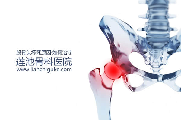 股骨頭壞死原因？如何治療股骨頭壞死？