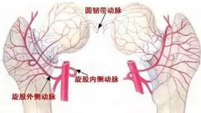 股骨頭壞死和腎虛是否有關(guān)系？