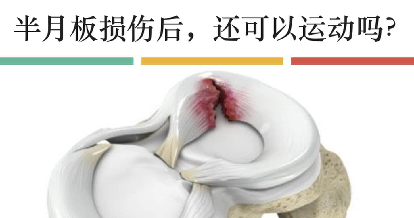 半月板損傷如何發(fā)生？半月板損傷多久能恢復(fù)