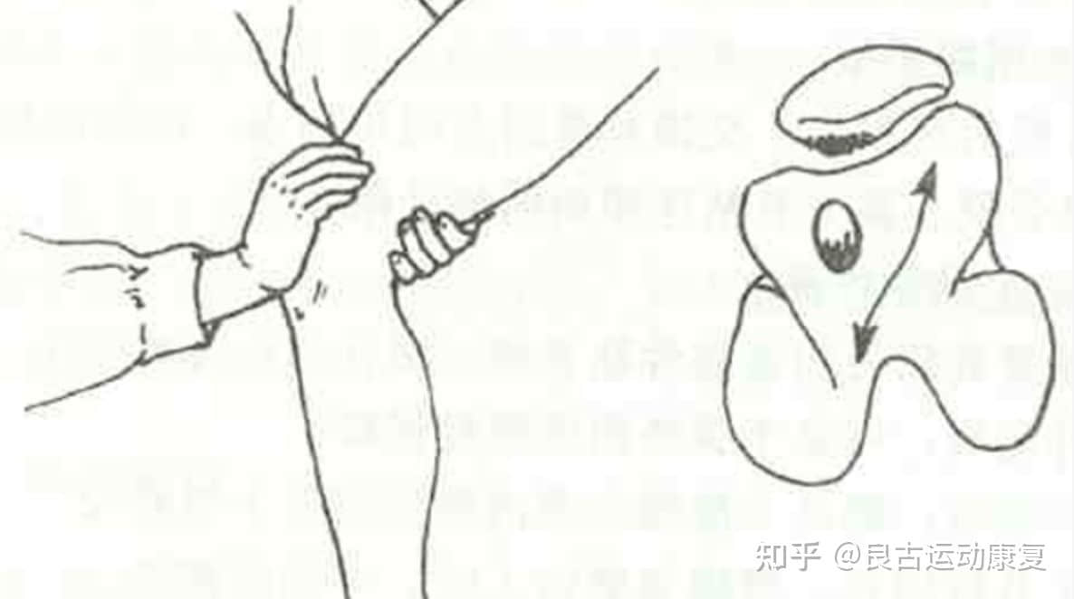 這個(gè)膝痛是最常見的運(yùn)動(dòng)損傷，如何自我康復(fù)？