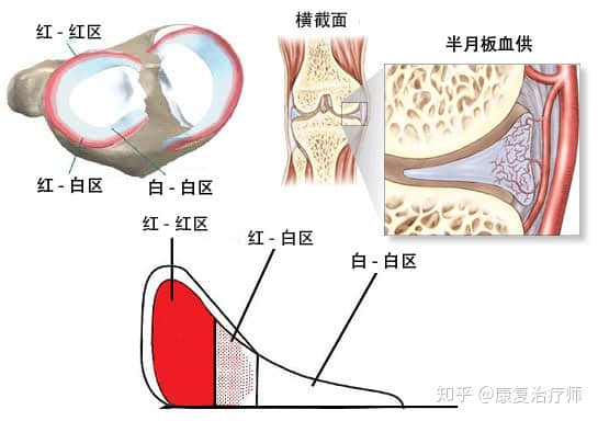 半月板損傷了，選擇修復還是切除？