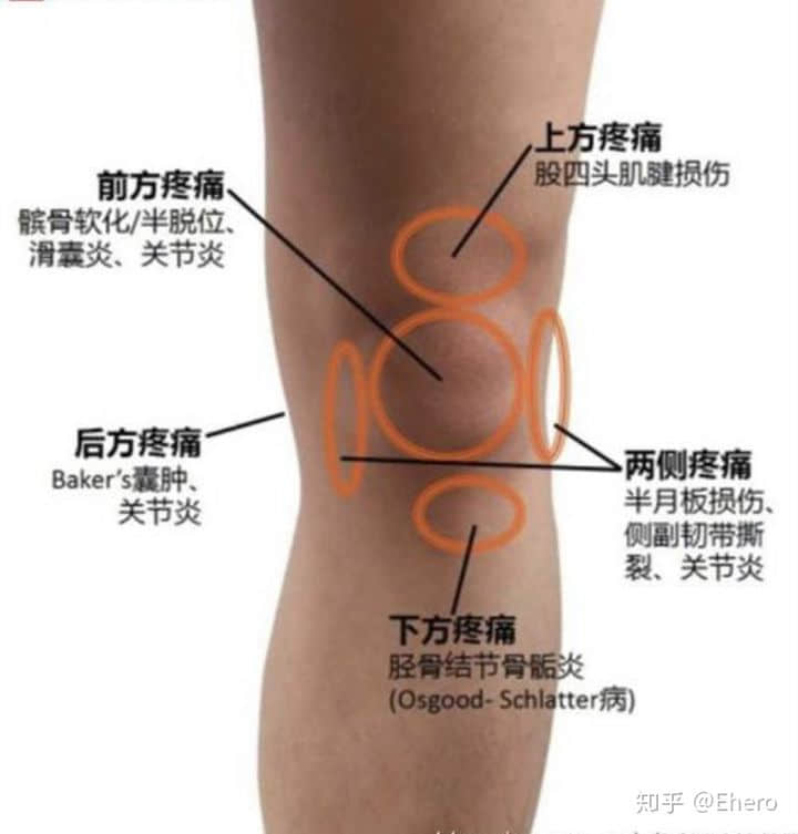 膝關(guān)節(jié)總發(fā)出聲響是怎么回事？
