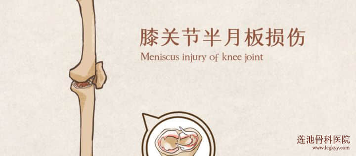 關(guān)節(jié)鏡手術(shù)的體驗(yàn)如何？