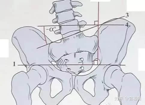 蹺二郎腿，是怎么讓人悄悄“變丑”的？